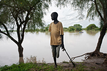 File photo: A boy with an amputated leg due to lack of access to care after being bitten by a snake, on the banks of the Pibor River in Jonglei State. ©Cédric Gerbehaye/Agence Vu